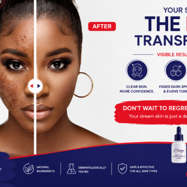 Creams for Skin Whitening in Kenya